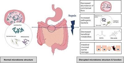 Contribution of gut microbiota toward renal function in sepsis